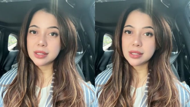 Dokter Kamelia Bongkar Alasan Putus dari Ammar Zoni: Ini Pemicunya!