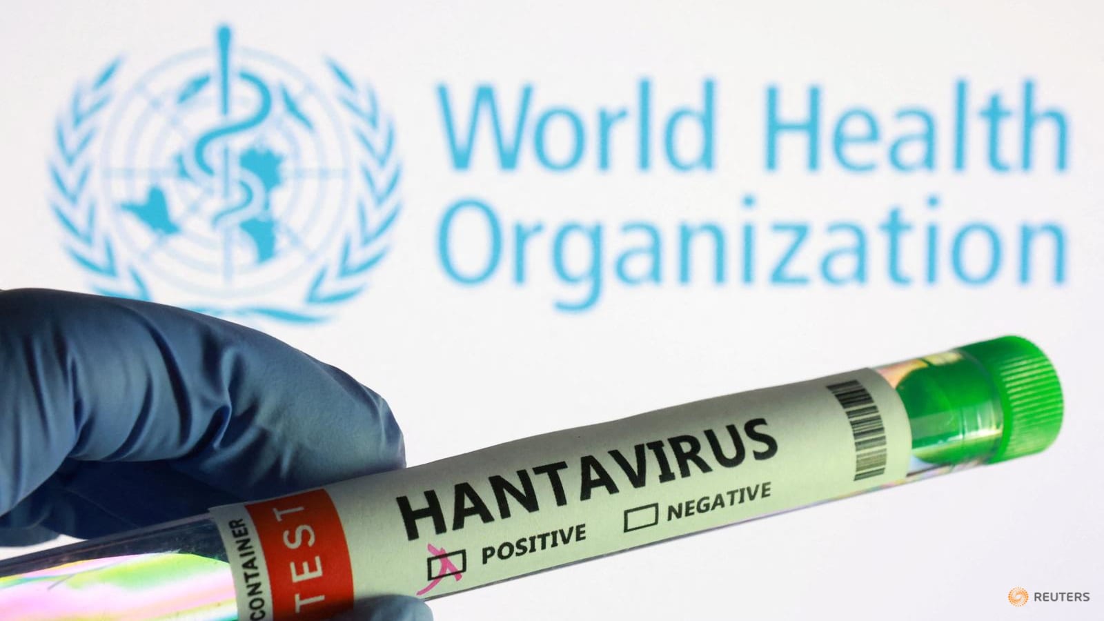 Hantavirus Mulai Mengancam di Kapal Pesiar: Ilmuwan Ingatkan Bahaya Terselubung di Era Perjalanan Global