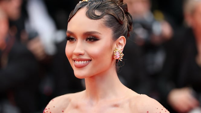 Cinta Laura Kejutan Fans, Muncul dari Ruang Operasi Gegara Kecelakaan Dapur