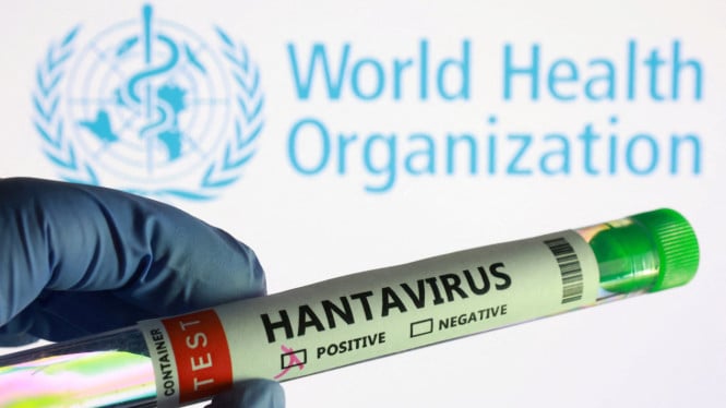 Ancaman Hantavirus di Kulon Progo Hilang, Warga Dinyatakan Sehat Usai Tes Laboratorium
