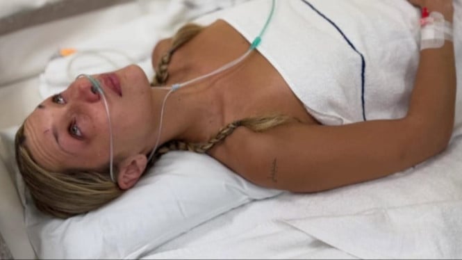 Bella Hadid Ungkap Perjuangan Nyata Melawan Penyakit Lyme: Cemas, Trauma, hingga Badai Emosi
