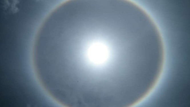 Pterygium: Ancaman Tersembunyi di Balik Paparan Sinar Matahari yang Perlu Diwaspadai
