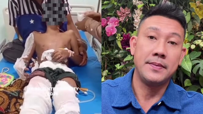 Denny Sumargo Bawa Kasus Santri Terbakar ke Publik, Desak Penyelidikan Tuntas di Lombok Tengah