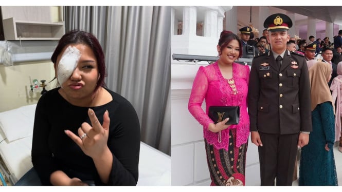 Tak Disangka, Trisha Eungelica Berjuang dengan Cedera Mata saat Saksikan Tribrata Putra Dilantik Perwira Polri