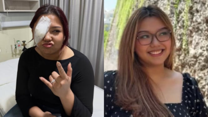 Kabar Gembira! Trisha Eungelica Sudah Sembuh dari Cedera Mata, Kembali Beraktivitas Normal