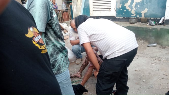Aksi Pencurian Kabel Gardu Berakhir Tragis: Pria Tanjung Priok Terbakar 70 Persen Tersengat Listrik Ribuan Volt