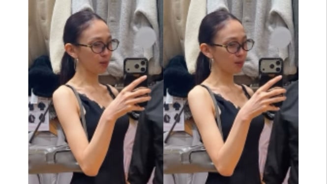 Kondisi Fisik Jule Memicu Kekhawatiran Publik Usai Terlibat Kasus Etomidate